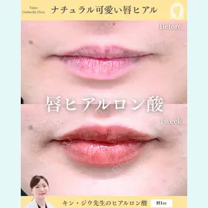 症例