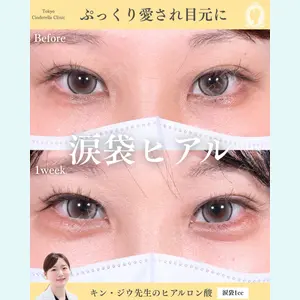 症例