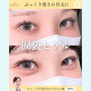 症例