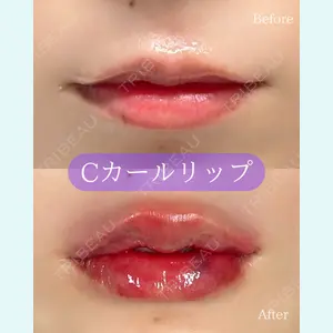 症例