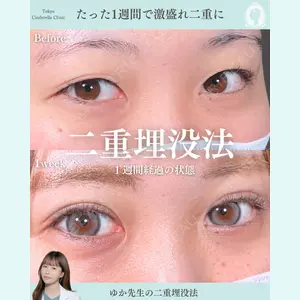 症例