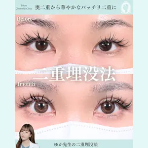 症例