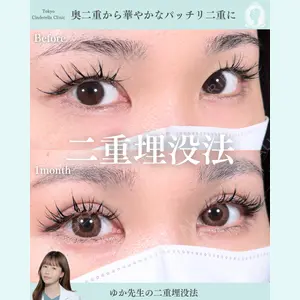 症例