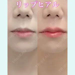 症例