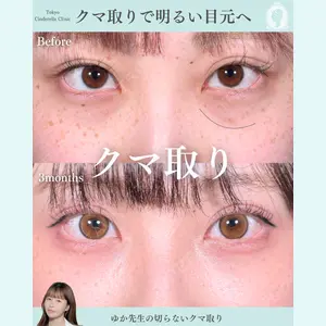 症例