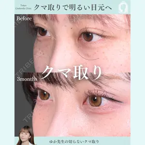 症例