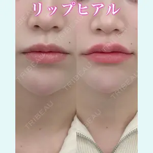 症例