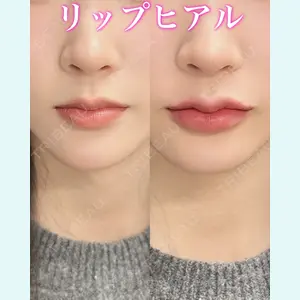 症例