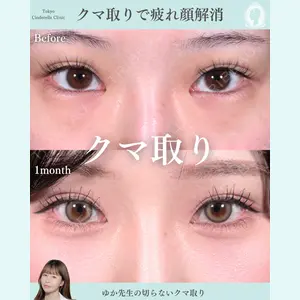 症例