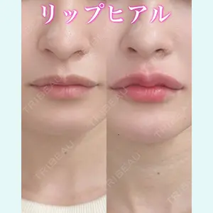 症例