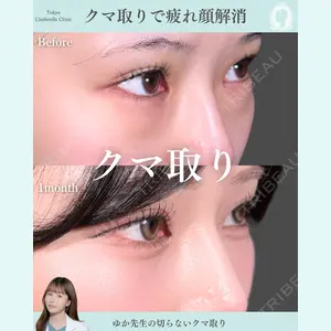症例
