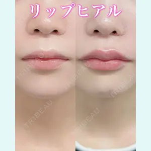 症例