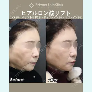 症例
