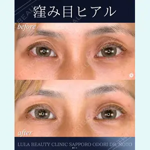 症例
