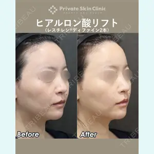 症例
