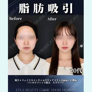 症例