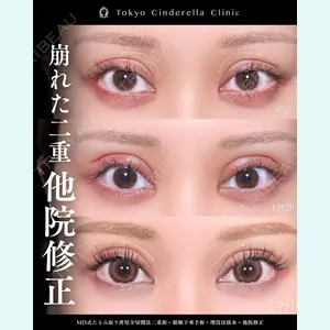 症例