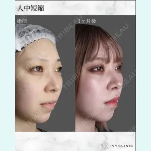 症例
