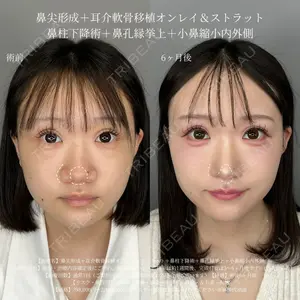 症例