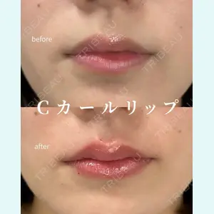 症例