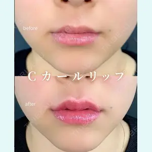 症例