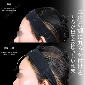 症例