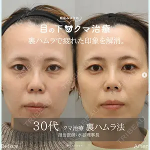 症例