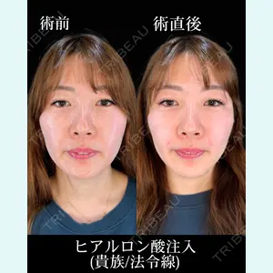 症例