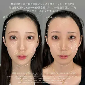 症例
