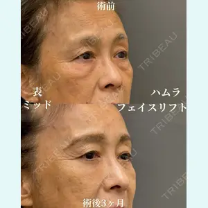 症例