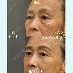 症例