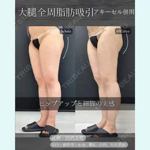症例