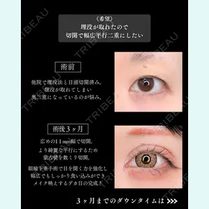症例