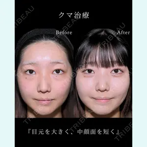 症例