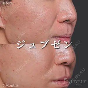症例