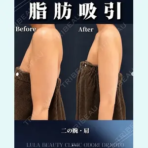 症例