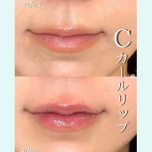 症例