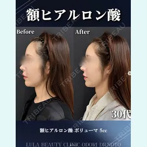 症例