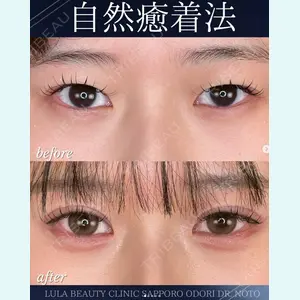 症例