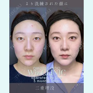 症例