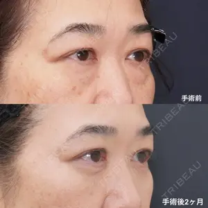 症例
