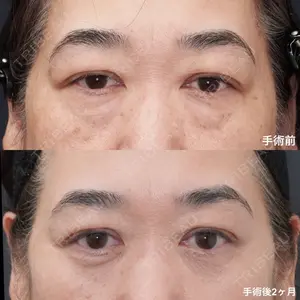 症例