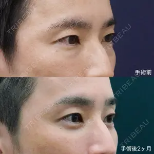 症例
