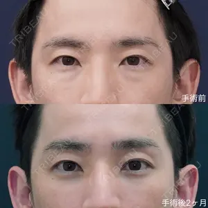 症例