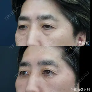 症例