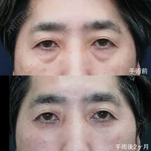 症例