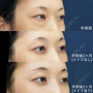 症例