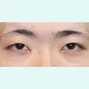 症例
