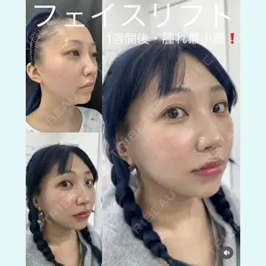 症例