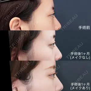 症例